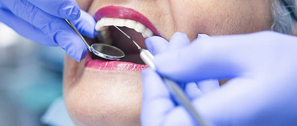 Best Emergency Root Canal Treatment in Ceredo, WV